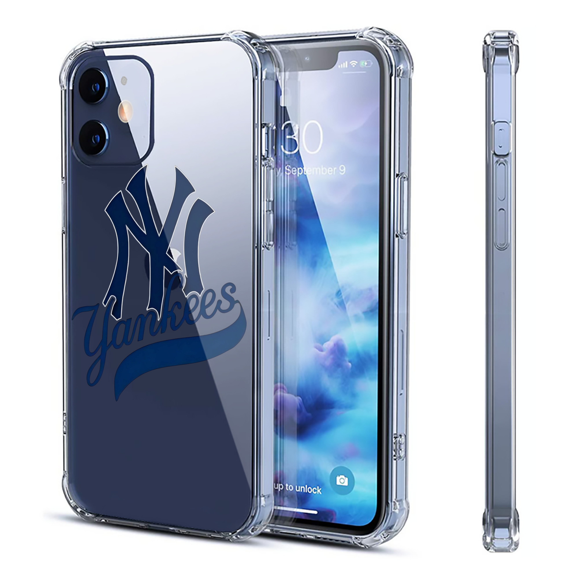 New York Yankees Logo Clear IPhone 12 Case – Soft TPU With UV Print – Enhanced Drop Protection, Precise Fit, Anti-Fingerprint, Customizable Design, Scratch-Resistant, Yellow-Resistant